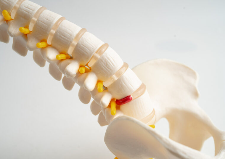 ヘルニアは整骨院でみてもらえる？手術が必要か迷っている方へ【堺市】